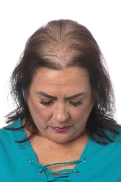 Perfect Topper By Toni Brattin | Heat-Friendly Synthetic -Wig Discount Store TB PerfectTopper Product3 Before